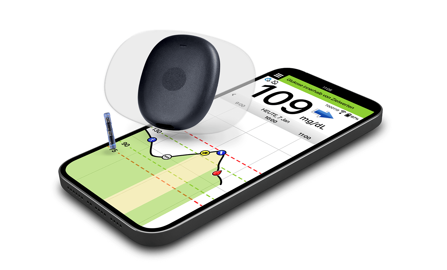 Das Eversense Langzeit-CGM Ger&auml;t schwebt &uuml;ber einem Smartphone, das eine App zur Glukose&uuml;berwachung anzeigt.