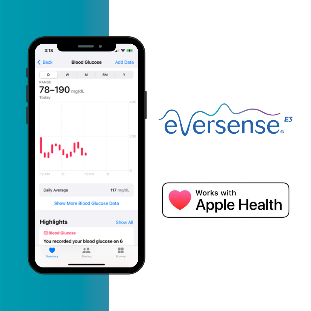 Smartphone zeigt die Eversense App zur Aufzeichnung des Glukosespiegels an.